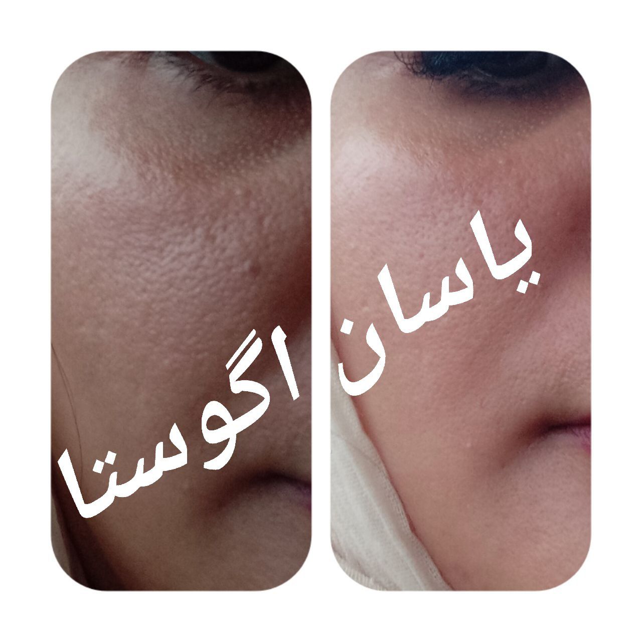 کرم سه کاره یاسان آگوستا | لیفتینگ و برطرف کننده منافذ